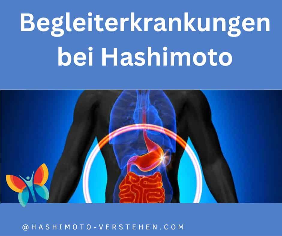 Begleiterkrankungen bei Hashimoto
